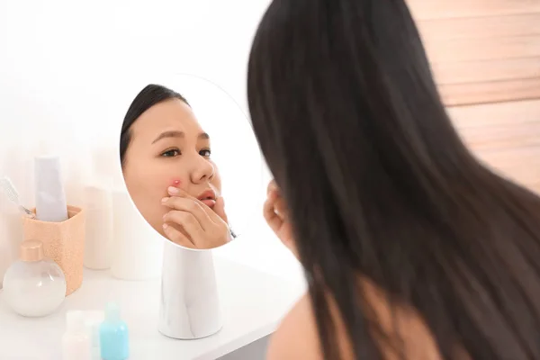 Young woman with acne problem squishing pimples near mirror — caucasian,  looking - Stock Photo | #405843428