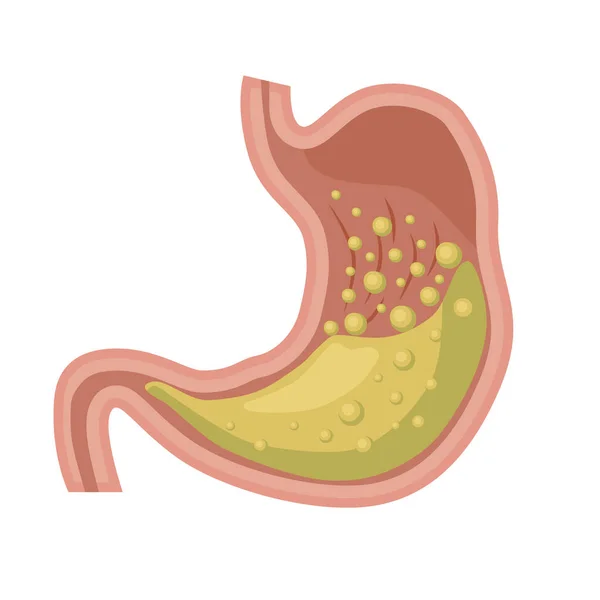 Estómago Humano Anatomía Estructura Órganos Internos Vector Del Sistema Digestivo — Archivo Imágenes Vectoriales