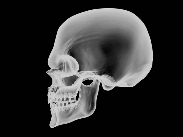 Skull Side View Ray Visual Effect — Stock Photo, Image