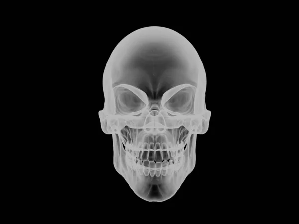 Crânio Visão Frontal Raio Efeito Visual — Fotografia de Stock