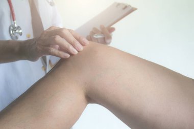 Hastanede muayene adam bacak doktor. Hasta kırık bacak için kontrol fizyoterapist.