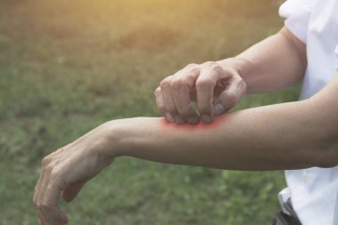 Adam el ile sıfırdan kaşıntı. Adam sağlık kavramı onun kol tırmalamak.