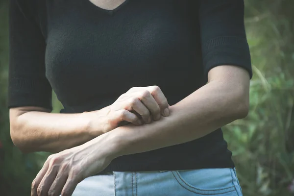 Vrouw Kras Jeuken Met Hand Vrouwelijke Krabben Van Haar Arm — Stockfoto