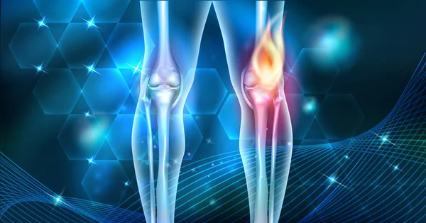 Pijn Abstracte Kniegewricht Branden Ontwerp Een Mooie Donker Blauwe Abstracte — Stockvector