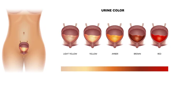 尿カラーチャート赤色まで黄色の光から 膀胱の詳細な解剖学と尿中 — ストックベクタ
