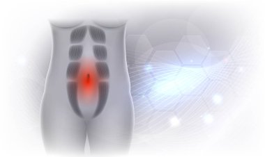 Tabii Recti olarak da bilinen tabii Rektus Abdominus veya karın ayrılık, hamile kadınlar ve sonrası Doğum arasında yaygındır. Rektus karın kasları arasında bir boşluk var. Güzel açık gri parlak renkli.