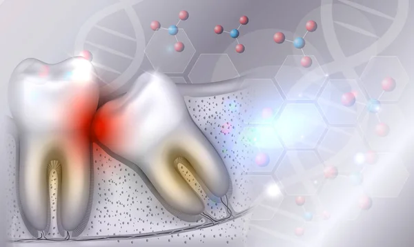 Weisheitszahn Eruptionsprobleme Veranschaulichten Die Anatomie Auf Einem Schönen Hellgrau Glühenden — Stockvektor
