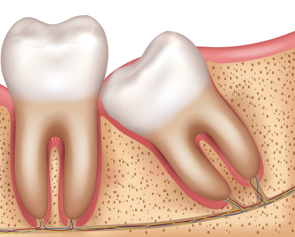 Wisdom tooth eruption problems illustrated anatomy