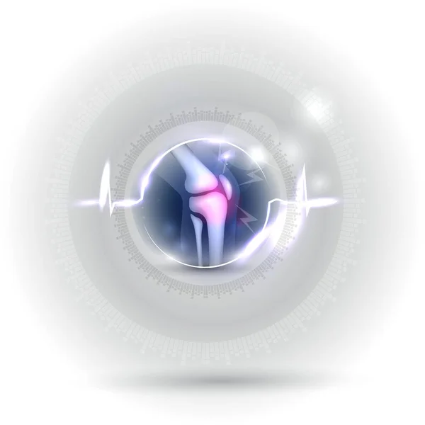 Problèmes Articulaires Concept Traitement Anatomie Articulaire Genou Intérieur Forme Cardiogramme — Image vectorielle