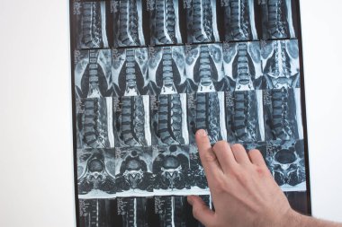 Doktor el Mri sonuçları bir şey gösterir (manyetik rezonans t