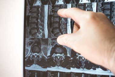 Doktor el Mri sonuçları bir şey gösterir (manyetik rezonans t