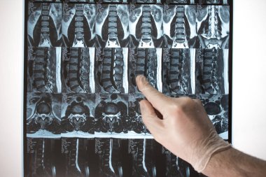 Doktor el Mri sonuçları bir şey gösterir (manyetik rezonans t