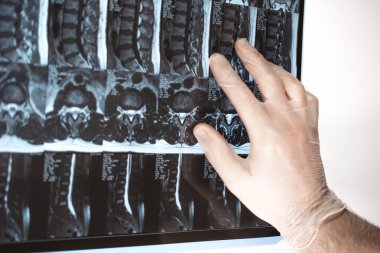 Doktor el Mri sonuçları bir şey gösterir (manyetik rezonans t