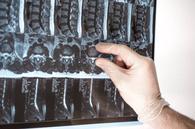Doktor el Mri sonuçları bir şey gösterir (manyetik rezonans t