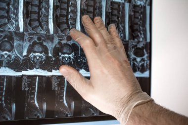 Doktor el Mri sonuçları bir şey gösterir (manyetik rezonans t