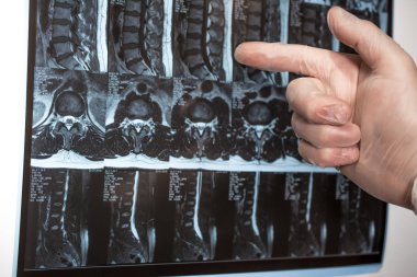 Doktor el Mri sonuçları bir şey gösterir (manyetik rezonans t