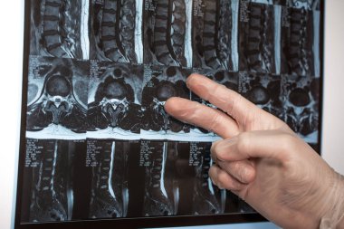 Doktor el Mri sonuçları bir şey gösterir (manyetik rezonans t