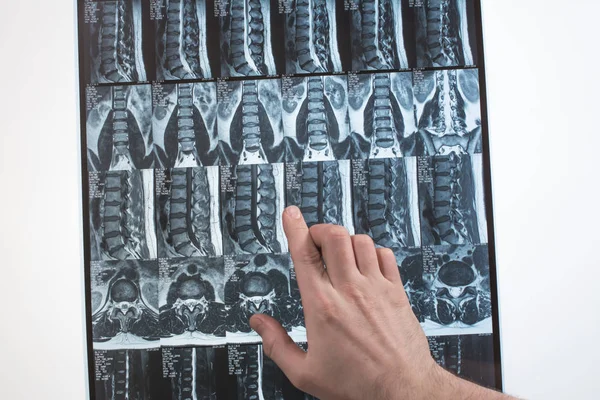 Arzt Hand zeigt etwas auf mri Ergebnisse (Magnetresonanztomographie t — Stockfoto