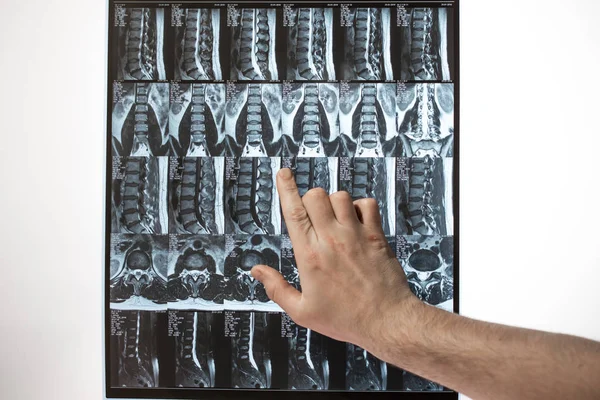 Arzt Hand zeigt etwas auf mri Ergebnisse (Magnetresonanztomographie t — Stockfoto