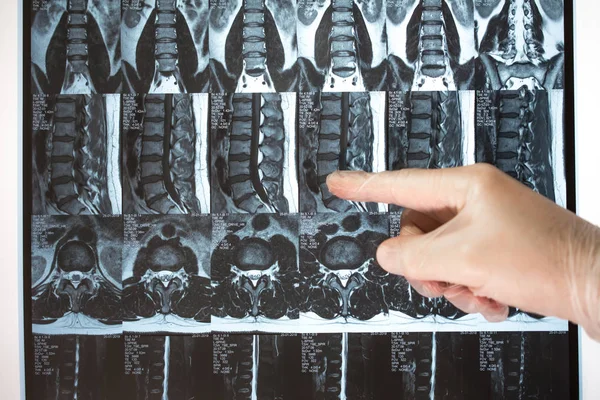 Arzt Hand zeigt etwas auf mri Ergebnisse (Magnetresonanztomographie t — Stockfoto