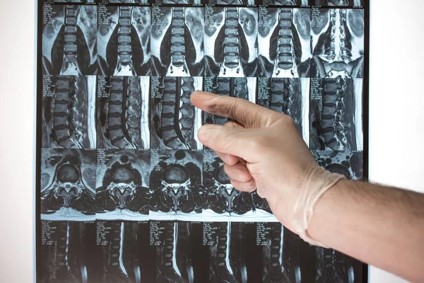 Arzt Hand zeigt etwas auf mri Ergebnisse (Magnetresonanztomographie t — Stockfoto