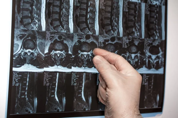 Doktor el Mri sonuçları bir şey gösterir (manyetik rezonans t — Stok fotoğraf