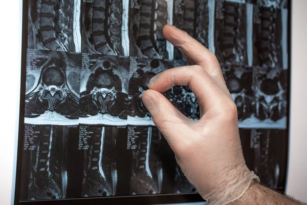 Doktor el Mri sonuçları bir şey gösterir (manyetik rezonans t — Stok fotoğraf