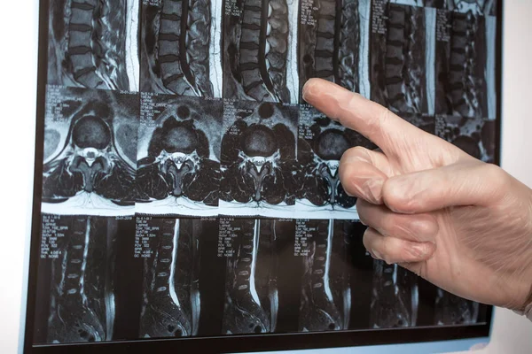 Doktor el Mri sonuçları bir şey gösterir (manyetik rezonans t