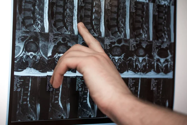 Doktor el Mri sonuçları bir şey gösterir (manyetik rezonans t