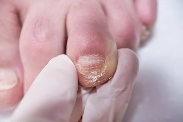 Ποδίατρος Θεραπεύει Πόδια Κατά Διάρκεια Της Επέμβασης Εξετάζει Πόδι Επαγγελματικό — Φωτογραφία Αρχείου