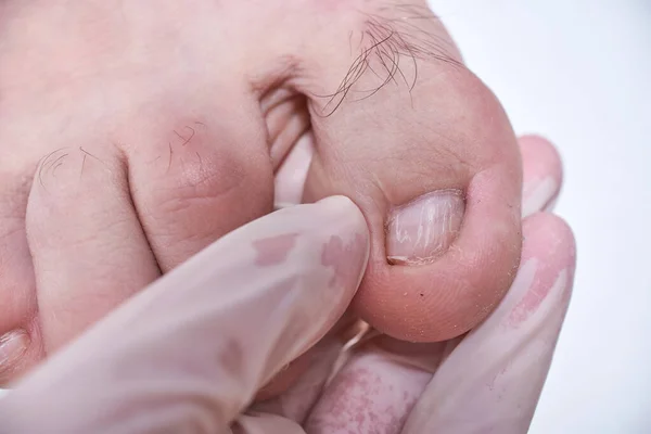 Médico Podólogo Hace Examen Del Pie Del Paciente Clínica Podólogo — Foto de Stock