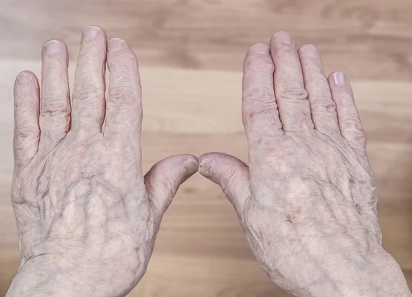 Zbliżenie Pomarszczone Ręce Starszy Osoby — Zdjęcie stockowe