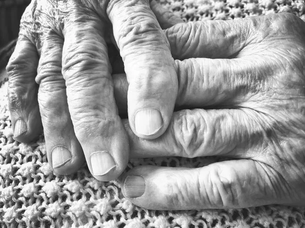 Closeup wrinkled hands of an old person