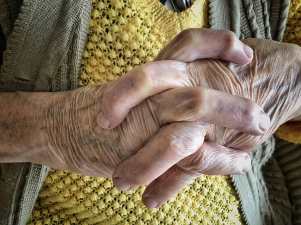 Крупним планом зморщені руки старої людини — стокове фото