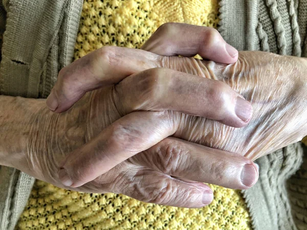 Les mains froissées d'une personne âgée — Photo