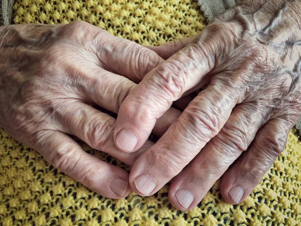 Closeup wrinkled hands of an old person — Stock Photo, Image