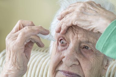 Gözlerine damla damlatan son sınıf bir kadın.