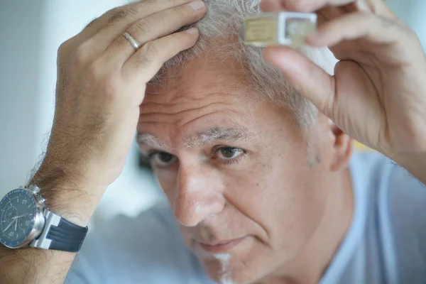 Hombre Mayor Tratando Pérdida Cabello — Foto de Stock