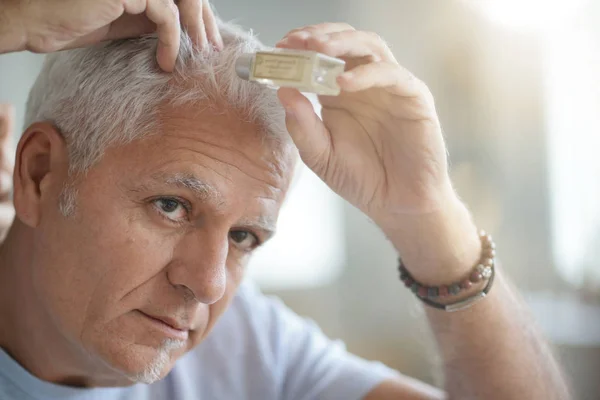 Senior Mann Behandelt Haarausfall — Stockfoto