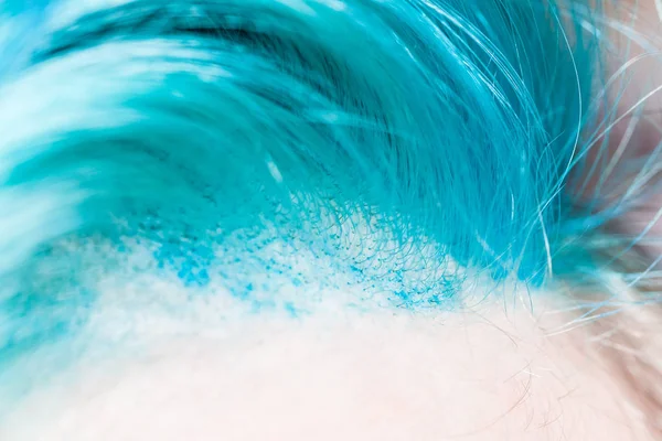 Gefärbte Kopfhaut Und Wurzeln Farbiger Haare Aus Nächster Nähe — Stockfoto
