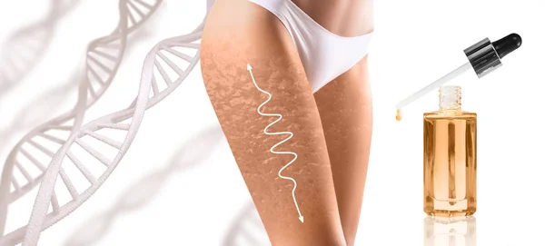 Жінка стегна з целюліту і білою стрілкою між ДНК stemps. — стокове фото