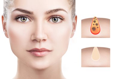 Güzel kadın kirletecek ve yüz gözenekleri temizlemek nasıl gösterir.