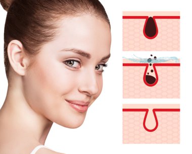 Güzel kadın kirletecek ve yüz gözenekleri temizlemek nasıl gösterir.