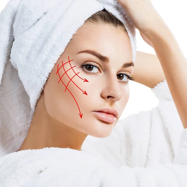 Woman in bathrobe with lifting lines on face.