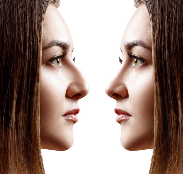 Mujer joven en perfil antes y después de la rinoplastia . —  Fotos de Stock