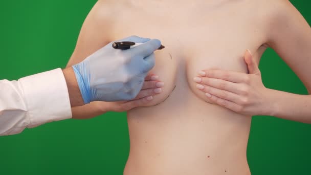 Chirurgie plastique pour correction mammaire féminine . — Video