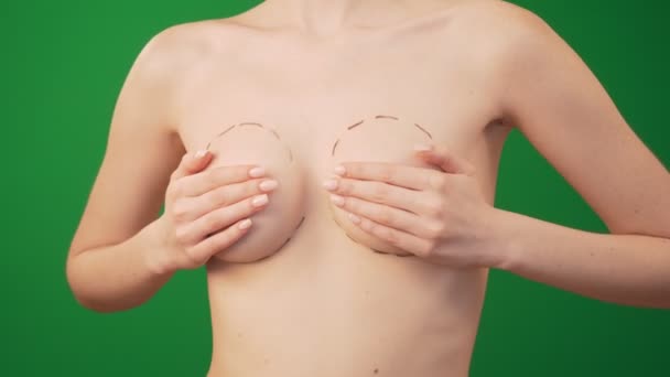 Plastická chirurgie pro korekci ženských prsou. — Stock video