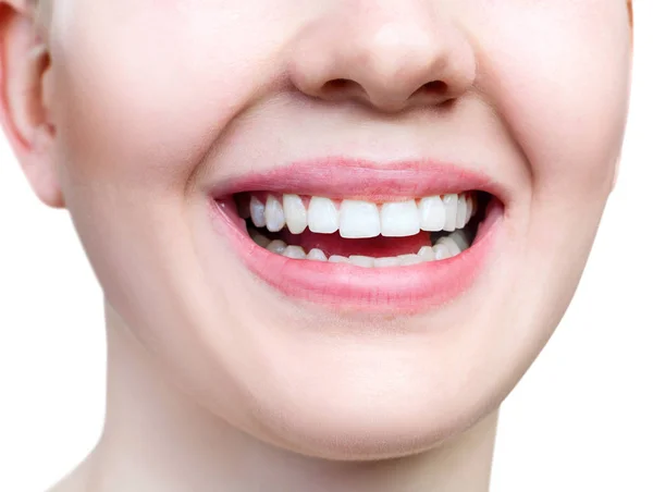 Sonrisa saludable de cerca de la joven. Dientes blancos perfectos . — Foto de Stock