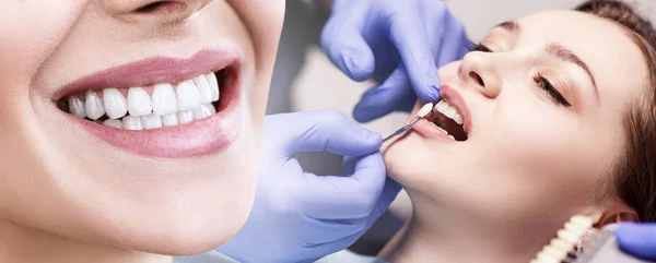 Collage de sourire parfait après une visite chez le dentiste . — Photo