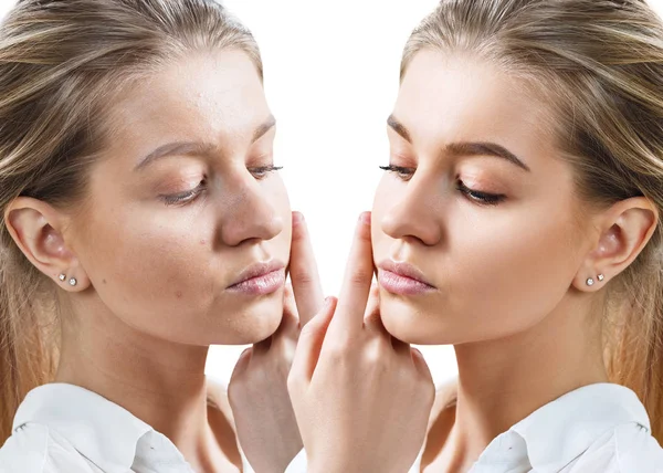 Mujer joven antes y después del tratamiento de la piel y maquillaje . — Foto de Stock